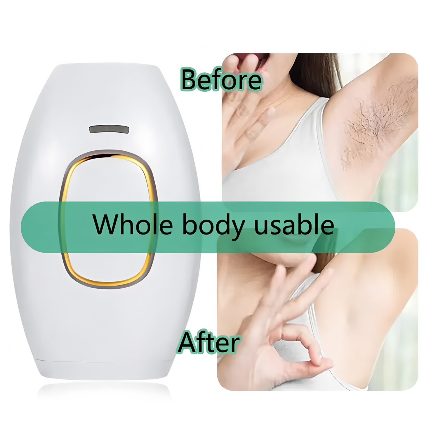 Perangkat Penghilang Bulu Lase - From Home Hair Care ulasan dan harga